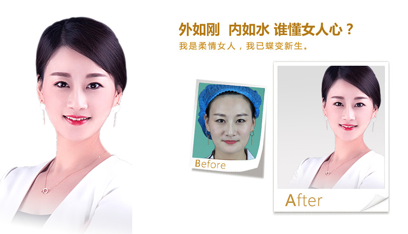 珠海V脸、线雕隆鼻